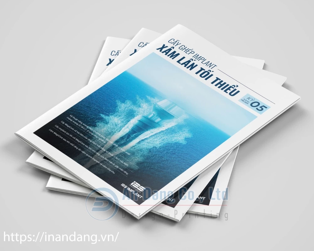 Mẫu catalogue chia sẻ việc cấy ghép Implant kỳ 5 cho công ty IBS Implant